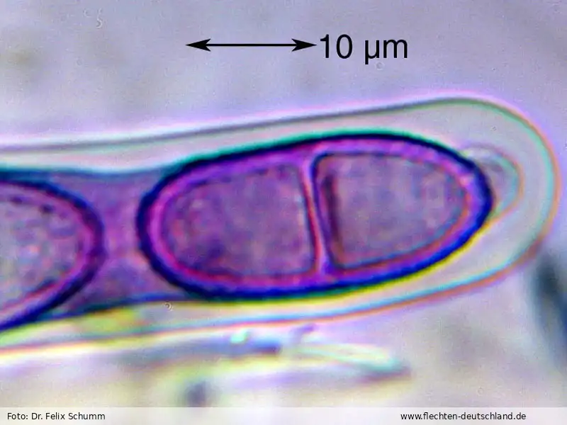 Sporen | Foto von Dr. Felix Schumm