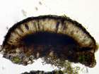 Amandinea punctata (Hoffm.) Coppins & Scheid.
