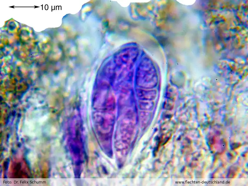 Sporen | Foto von Dr. Felix Schumm