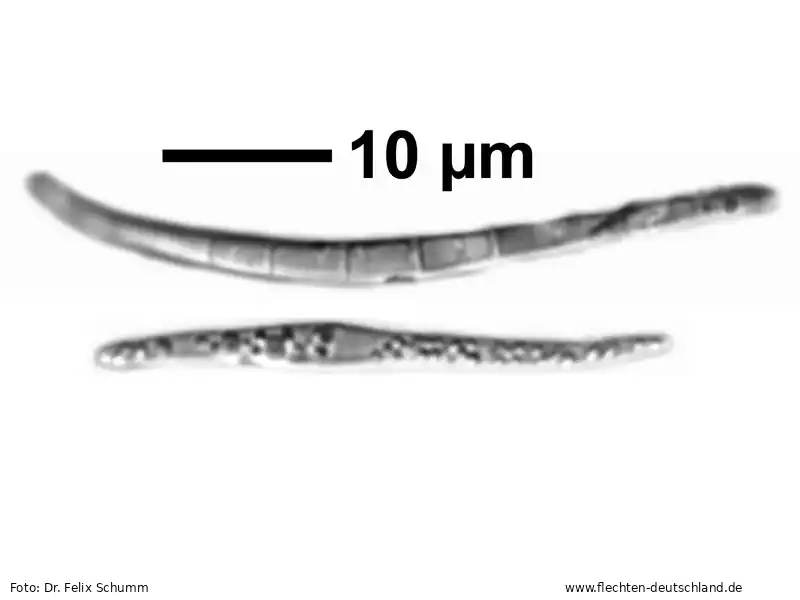 Querschnitt Fruchtkörper | Foto von Dr. Felix Schumm