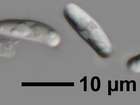 Caloplaca arenaria (Pers.) Müll. Arg.