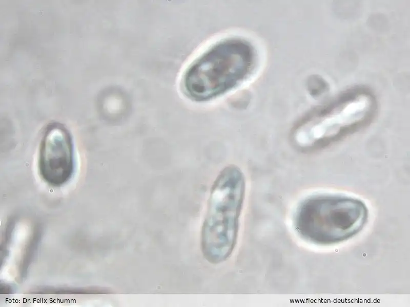 Querschnitt Fruchtkörper | Foto von Dr. Felix Schumm