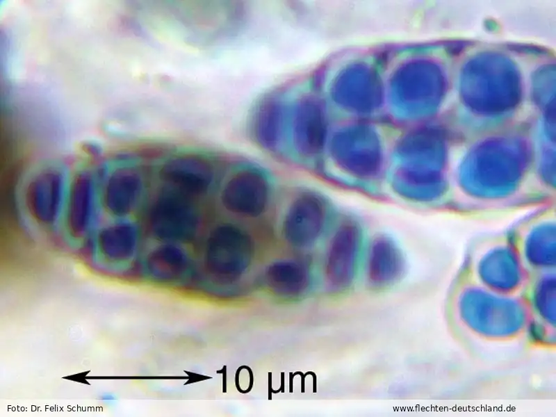 Querschnitt Fruchtkörper | Foto von Dr. Felix Schumm