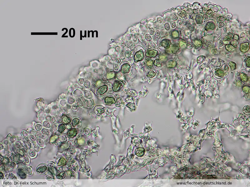 Mikromerkmale | Foto von Dr. Felix Schumm