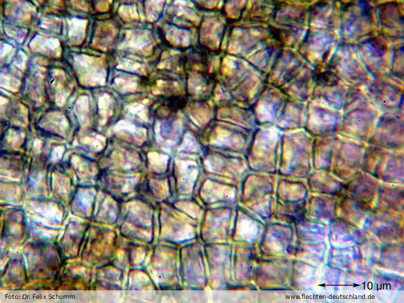 Mikromerkmale | Foto von Dr. Felix Schumm