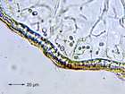 Leptogium schraderi (Bernh.) Nyl.