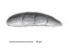 Micarea lignaria (Ach.) Hedl.