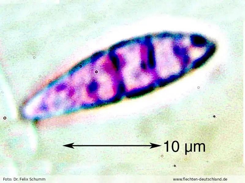 Querschnitt Fruchtkörper | Foto von Dr. Felix Schumm