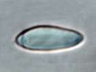 Mycobilimbia sanguineoatra (Wulfen) Kalb & Hafellner