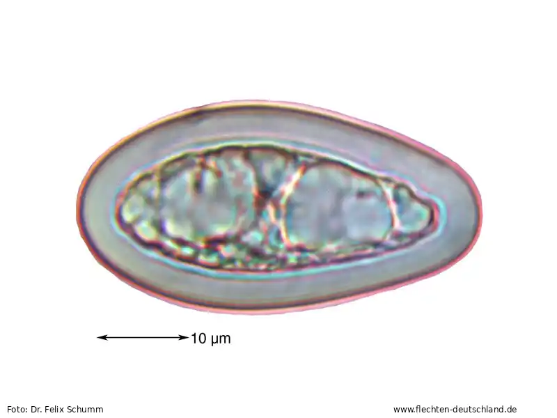 Querschnitt Fruchtkörper | Foto von Dr. Felix Schumm