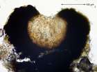 Opegrapha dolomitica (Arnold) Clauzade & Cl. Roux ex Torrente & Egea