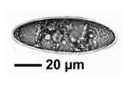 Pertusaria pustulata (Ach.) Duby