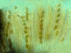 Polycoccum slaptonense D. Hawksw.