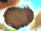 Weddellomyces xanthoparmeliae Calat. & Nav.-Ros.